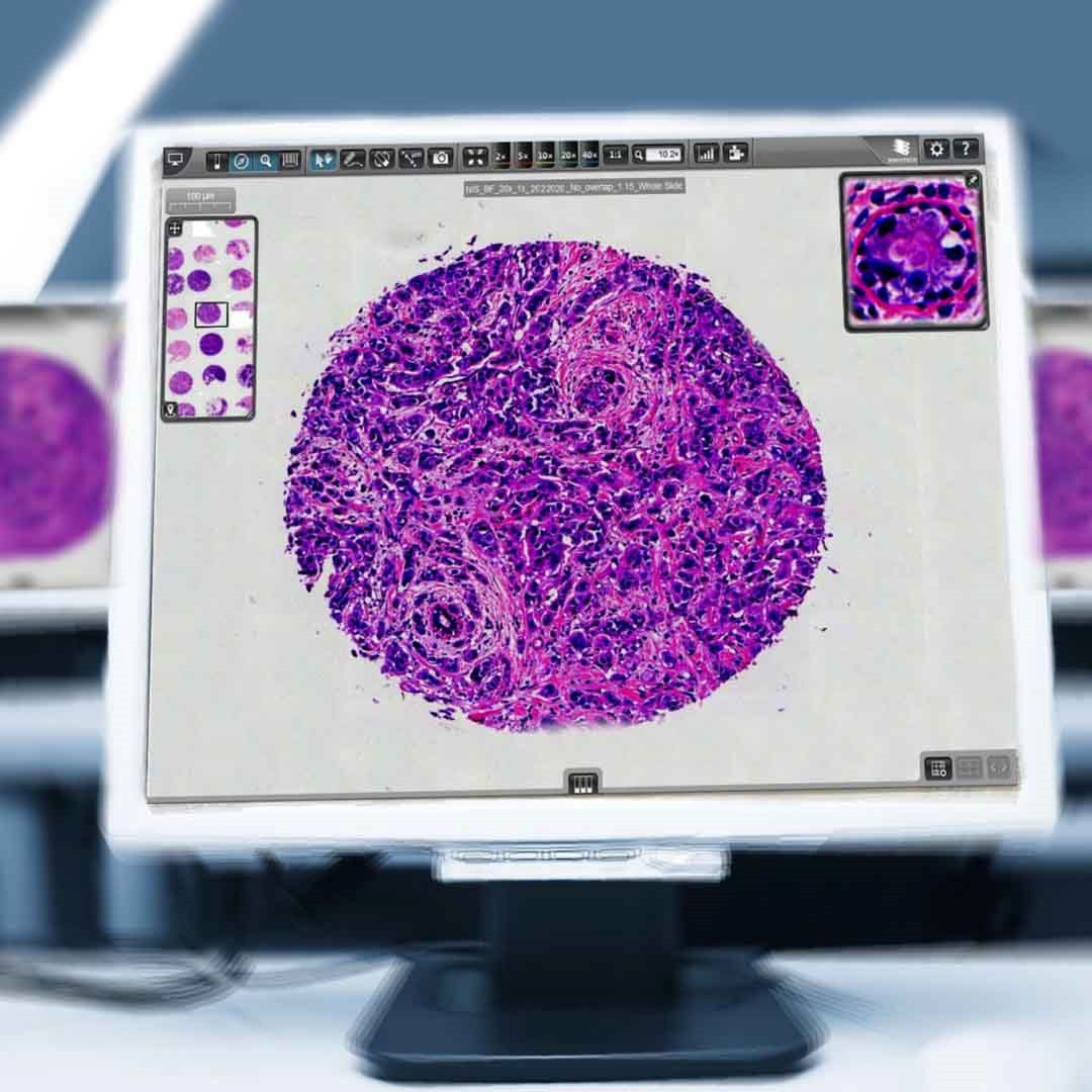 پرنوآ؛ راه‌اندازی سامانه جامع لام‌های دیجیتال